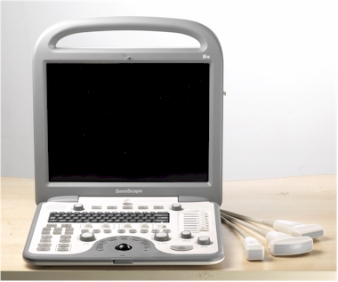 SonoScape S8