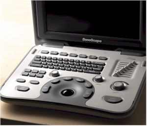 SonoscapeA6b.078392